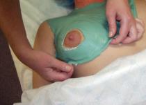 Коррекция груди после беременности и кормления Как привести в порядок грудь после кормления