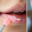 Маски для губ: домашние рецепты масок для увлажнения, питания и увеличения губ